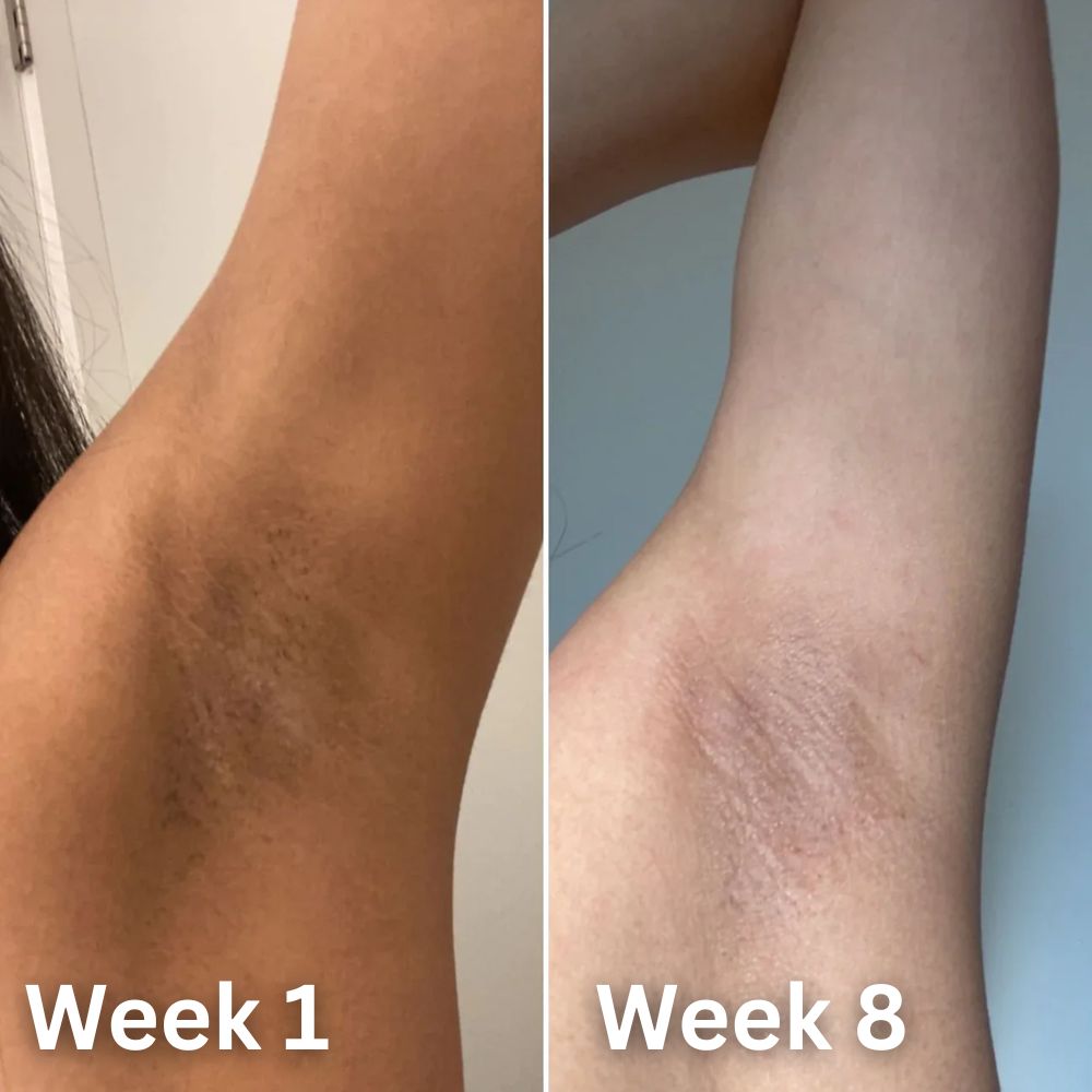 Sivanae Skin Brightening Deodorant