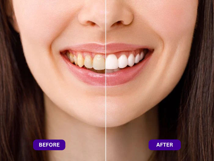 Sivanae™ Purple Mouth Wash