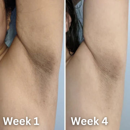 Sivanae Skin Brightening Deodorant