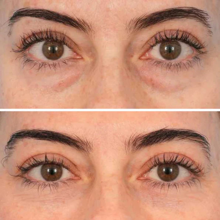 Deep Peptide Collagen Eye Mask