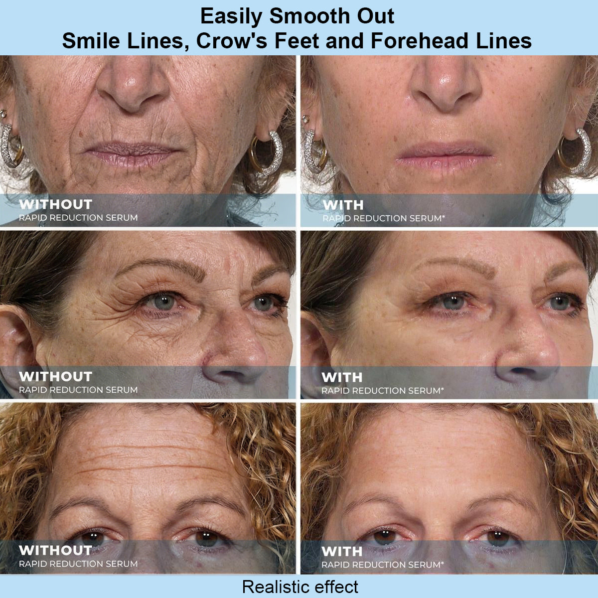 Sivanae™ Instant Face Temporary Tightener – Instant visible results in 30 seconds