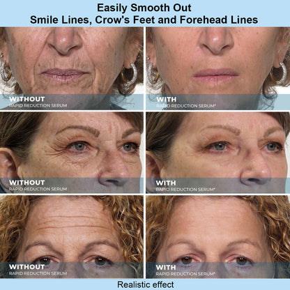 Sivanae™ Instant Face Temporary Tightener – Instant visible results in 30 seconds