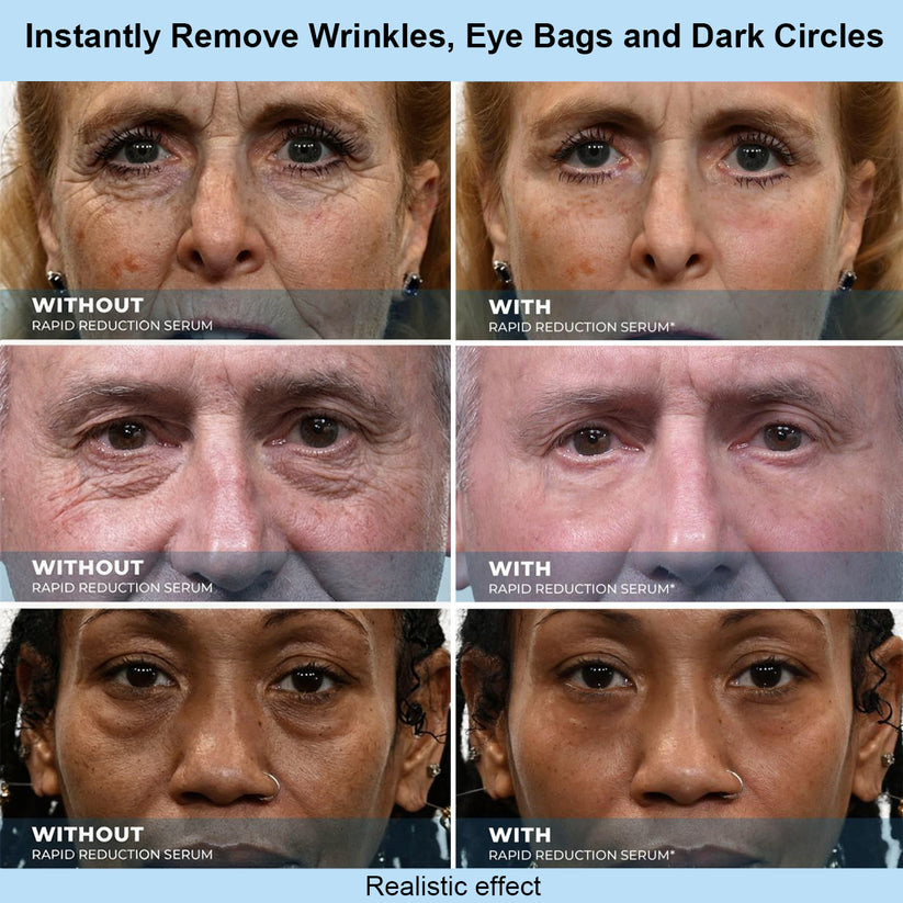 Sivanae™ Instant Face Temporary Tightener – Instant visible results in 30 seconds