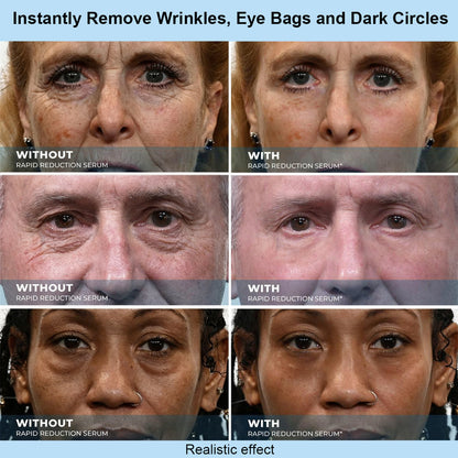 Sivanae™ Instant Face Temporary Tightener – Instant visible results in 30 seconds