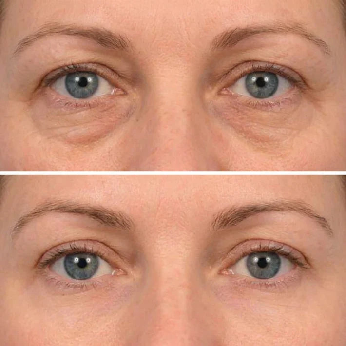 Deep Peptide Collagen Eye Mask