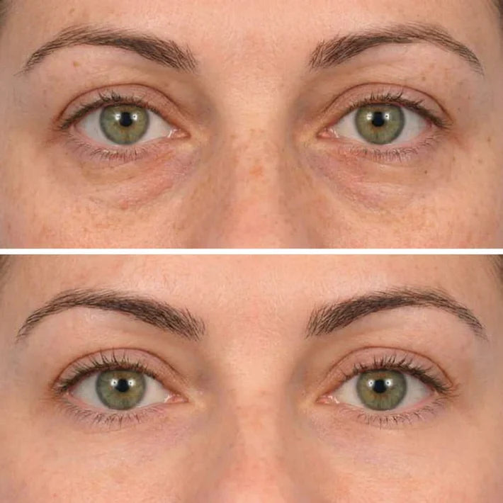 Deep Peptide Collagen Eye Mask