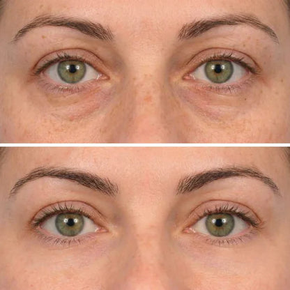 Deep Peptide Collagen Eye Mask