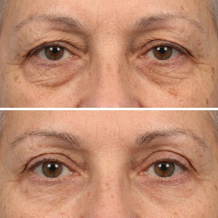 Deep Peptide Collagen Eye Mask