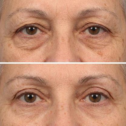 Deep Peptide Collagen Eye Mask
